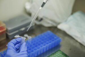 Brasil ultrapassa a marca de 1,7 milhão de casos de COVID-19 em 2023